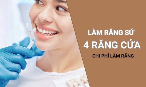 Chi Phí Làm Răng Sứ 4 Răng Cửa