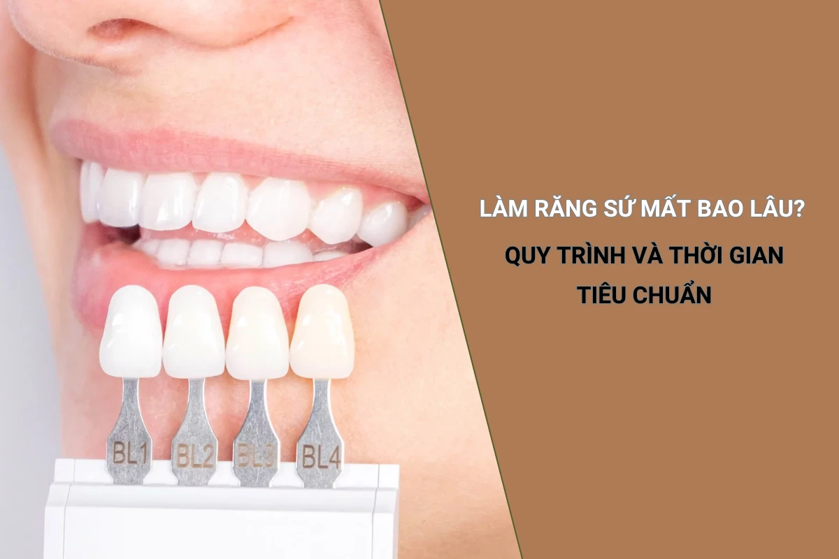 quy trình làm răng sứ mất bao lâu