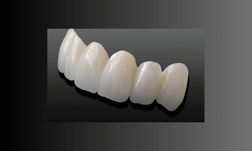 răng sứ Cercon
