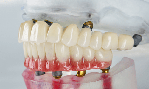 răng sứ thẩm mỹ