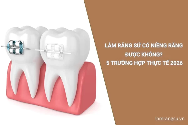 làm răng sứ có niềng răng được không