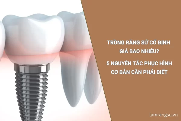 trồng răng sứ cố định